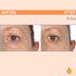 Serious Skincare C3 Vitamin C Ester Eye Beauty Treatment - 0.5 oz. with Hyaluronic Acid for Dull & Dry Under Eyes,