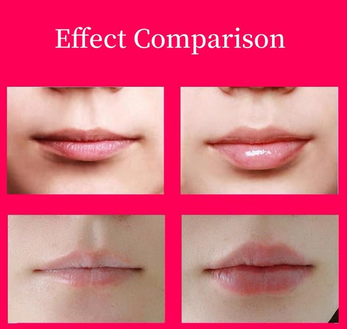 Lip Plumper Tool, Electric Lip Plumper, Lip Plumper Device, Lip Enhancer Plumper Tool, Lip Suction Plumper, 3.7V 500mAh (Sold By FUSHENFJ)