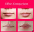 Lip Plumper Tool, Electric Lip Plumper, Lip Plumper Device, Lip Enhancer Plumper Tool, Lip Suction Plumper, 3.7V 500mAh (Sold By FUSHENFJ)