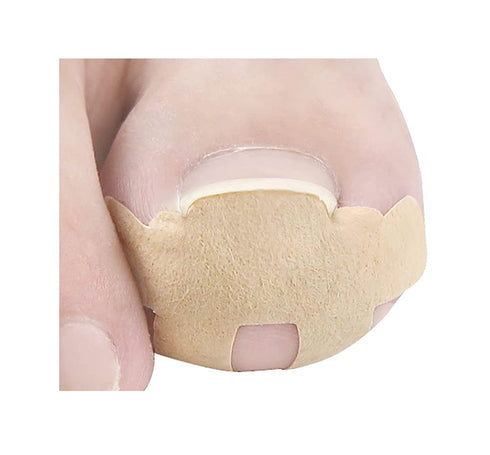 Ingrown Toenail Correction Stickers, 16 Pcs Thick Paronychia Corrector Patches for Nail Healing Care