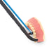 SDFlosser SDF Delivery System, Trial Pack