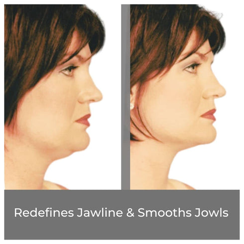 Instant Face Lift Tape Kit - 30-Day Supply of Transparent Neck & Eyebrow Lift Strips - Made in USA