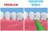 Piksters Interdental Brushes, Size 6, 40 pk, Gum Soft Bristles for Larger Gaps, Safe for Braces, Plaque Removal