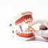 Dental IPR Strip System, 10 Pcs Orthodontic Interproximal Reduction Enamel Kits, Multi-Colored