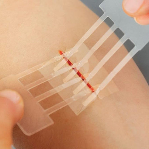 Clozex Emergency Laceration Kit - FDA Cleared Skin Closure Device for Wounds Up to 1.5 Inches