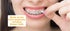 New Genuine Orthowax Plus - Precut with Aloe Vera & Vitamin E - Orthodontic Wax for Braces Wearer (Pack of 9) -