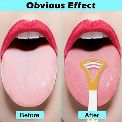 Tongue Scraper Cleaner Soft Tongue Scraper for Healthy Oral Care, 6PCS Tools for Adults and Kids