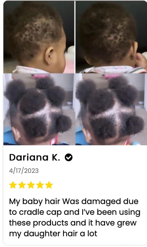 J'Organic Solutions Natural Kid's Hair Growth Stimulator, Hair Grease with Lanolin, Sweet Almond Oil, Castor Oil