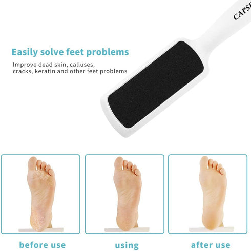 Pedicure Foot Rasp File Callus Remover, Double-Sided Colossal Foot File for Dead Skin (Pack of 4)