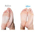 Pack 4 Emjoi Micro-Pedi Compatible SoftFLEX Technology Refill Rollers (Extra Coarse)
