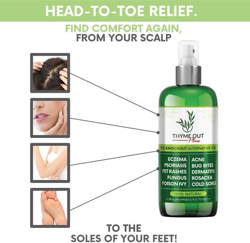 Thyme Out Plus Eczema Treatment, Psoriasis Treatment Treats Acne, Dermatitis, Rosacea, Cold Sores, Pet Rashes, Bug
