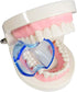 Dental Orthodontic Lip Cheek Retractor Expander Mouth Opener, Autoclavable, 15 Pieces/lot