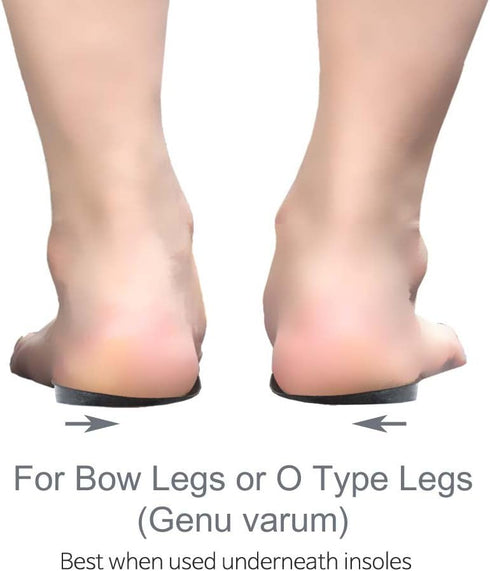 Knock-Knees Bow Legs O/X Type Medial & Lateral Heel Wedge Insoles for Knee Pain, 1 Pair