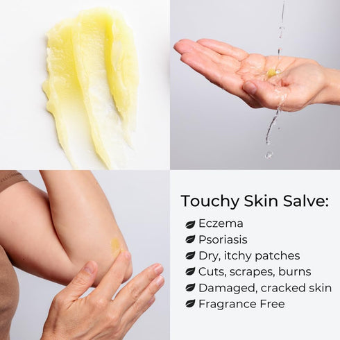 Touchy Skin Salve, Eczema Cream for Kids and Adults, Natural Itch Treatment, Calendula Ointment, 4 oz