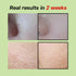 Green Tomato Pore Lifting Ampoule, 1.01 Fl Oz, Instant Pore Minimizing & Tightening Facial Serum