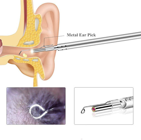 9PCS Earpick Spoon Accessories for 3.5mm Diameter Otoscope, Metal Ear Spoon for Adults and Children