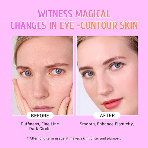 Under Eye Patches (30 Pairs), Gold Eye Mask with Hyaluronic Acid for Puffy Eyes, Dark Circles & Wrinkles Treatment