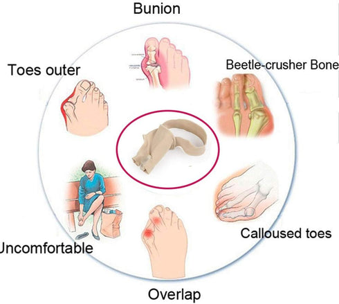 Bunion Straightener Protector Relief Sleeve with Gel, Cushioned Splint, Orthopedic Hallux Valgus Corrector, 2 Pcs (S)