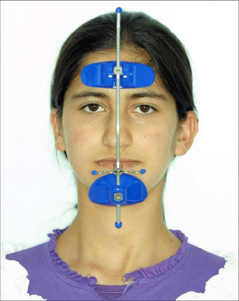 Sino Dental Orthodontic Multi-Adjustable High-Pull Reverse Face Mask (Blue)