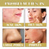 Retinol Snake Venom Peptide Gold Mask, Anti-Aging Moisturizing Peeling Mask for Skin Tightening and Nourishing
