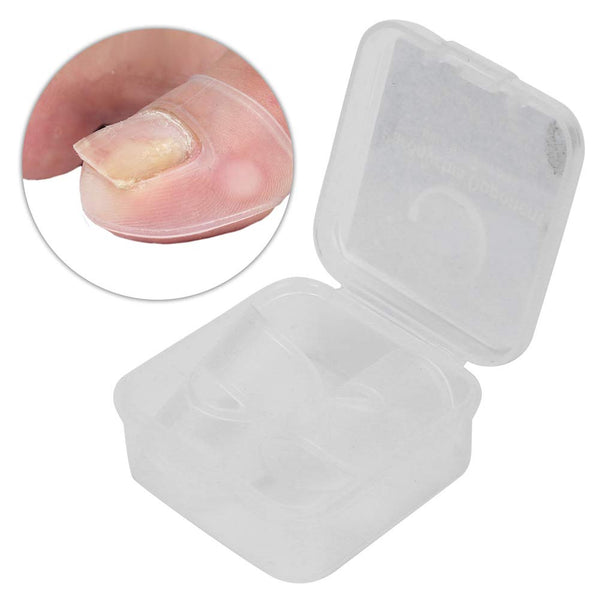 Silicone Ingrown Toenail Corrector, Treatment Tool for Nail Care, 1 Pair for Pedicure Recovery