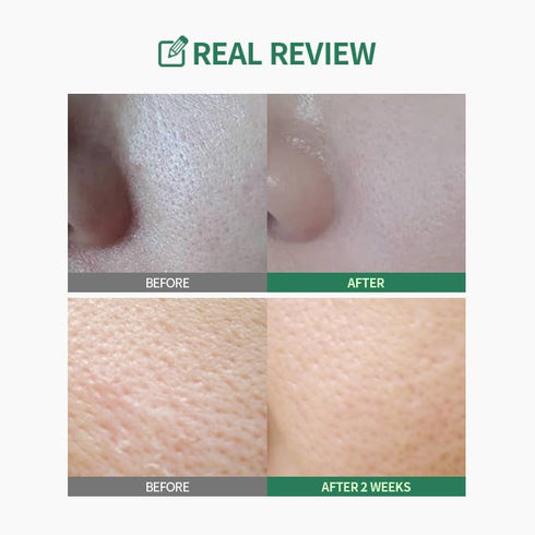 Green Tomato Double Cleansing Ampoule Oil, 200g, Daily Makeup Blackhead Melting for Women