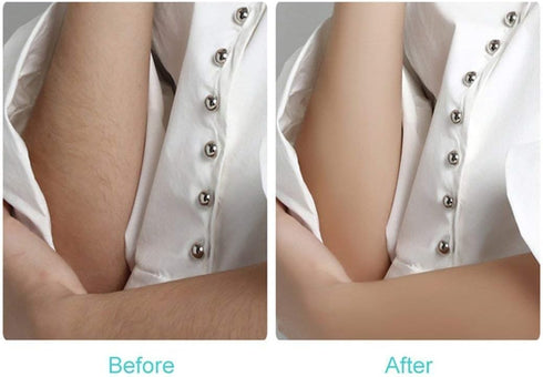 Rechargeable Epilator for Women, Hair Removal Tools with Sensor Light Epilator