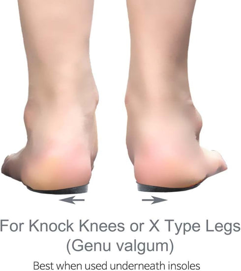 Knock-Knees Bow Legs O/X Type Medial & Lateral Heel Wedge Insoles for Knee Pain, 1 Pair