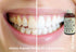 eSutras Pulling Oil Herbal Mouthwash, Coconut Sesame Sunflower Oils, Mint Clove, Whitens Teeth