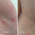 KAMEDIS Eczema Therapy Soothing Body Cream, Botanicals-based, Clinically Proven for Dry Skin