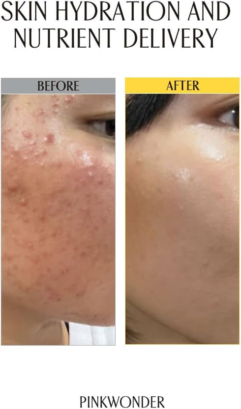 Jojoba Toner for Face 6.76oz (200ml), 100% Organic Jojoba Oil with Wild Strawberry, Deep Hydration