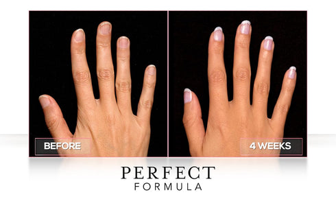 Perfect Formula Daily Moisture Treatment, 0.5 Fl Oz