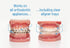 OrthoDots CLEAR – Moisture Activated Braces Wax Alternative for Pain Relief from Braces and Orthodontic Appliances