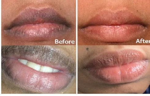 ZWSP 2PCS Lip Lightening Scrub Balm - Moisturizing Anti-Aging Hyaluronic Acid to Remove Dull Black Lips