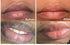 ZWSP 2PCS Lip Lightening Scrub Balm - Moisturizing Anti-Aging Hyaluronic Acid to Remove Dull Black Lips