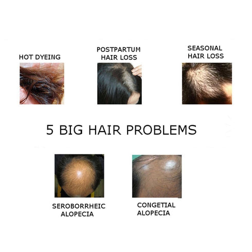 Natural Hair Growth Serum with Ginger Essential Oil | Anti Hair Loss Treatment for Thinning, Weak, Brittle Hair