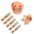 Ingrown Toenail Treatment - 50pcs Correction Stickers, Health Toenail Corrector Patches, Glue-Free Treatment Tool