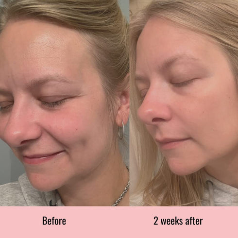 Vitamin C Serum 1 oz - Hyaluronic Acid for Face, Anti Aging, Menopause Support, Dark Spot Remover