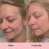 Vitamin C Serum 1 oz - Hyaluronic Acid for Face, Anti Aging, Menopause Support, Dark Spot Remover