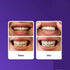 OSFRIAGE 14 Purple Teeth Whitening Strips,Gentle Daily Stain Reduction & Natural Shine, Portable for Home or On-The-Go