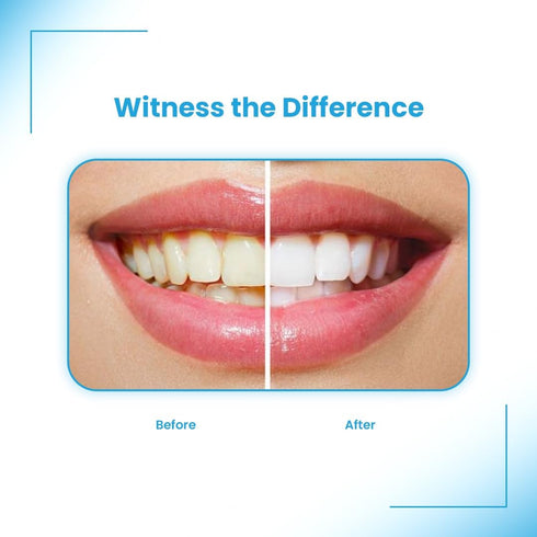 White Foam Aligner Cleaner + Whitener for Clear Aligners, Retainers, Mouth Guards, Teeth Whitening Trays