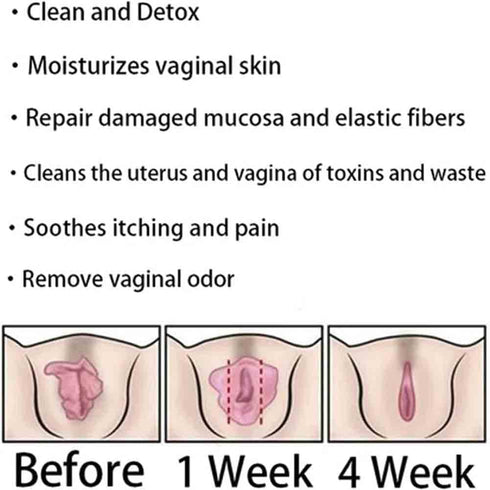 Weabet Slimming (8Bag) Instant Anti-Itch Detox Products, Natural Detox Viginal Capsulesa, Natural Detox Viginal Gel