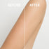 Microdermabrasion Keratosis Pilaris, Folliculitis & Acne Exfoliating Deep Cleansing Scrub Soap, KP Bump Eraser