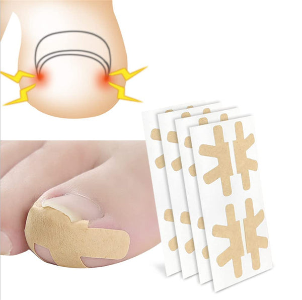 Ingrown Toenail Correction Stickers, 16 Pcs Thick Paronychia Corrector Patches for Nail Healing Care