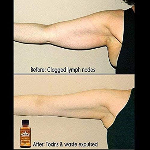 Meifen 3 Pack Lymphatic Drainage Ginger Oil, Ginger Massage Oil to Promote Blood Circulation,Suitable for Body Massage
