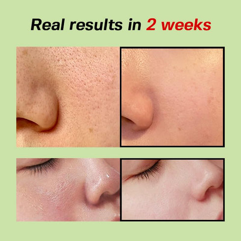 Green Tomato Pore Lifting Ampoule, 1.01 Fl Oz, Instant Pore Minimizing & Tightening Facial Serum