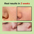 Green Tomato Pore Lifting Ampoule, 1.01 Fl Oz, Instant Pore Minimizing & Tightening Facial Serum
