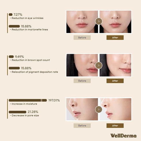 WELLDERMA Sapphire Collagen Face Mask - 4EA Premium Overnight Hydrogel Mask for All Skin Types with Niacinamide