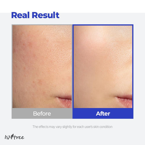 IsNtree Hyaluronic Acid Aqua Gel Cream 100ml, Korean Skincare, Lightweight Moisturizer for Oily to Combination Skin