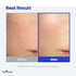 IsNtree Hyaluronic Acid Aqua Gel Cream 100ml, Korean Skincare, Lightweight Moisturizer for Oily to Combination Skin